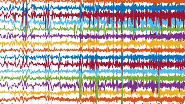 Using Machine Learning to Predict Epileptic Seizures from EEG Data