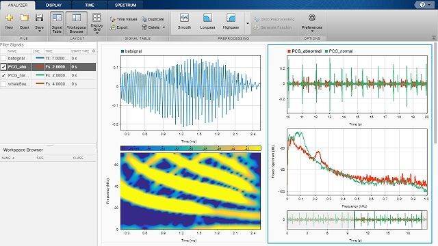 Perform signal processing, analysis, and algorithm development using Signal Processing Toolbox.