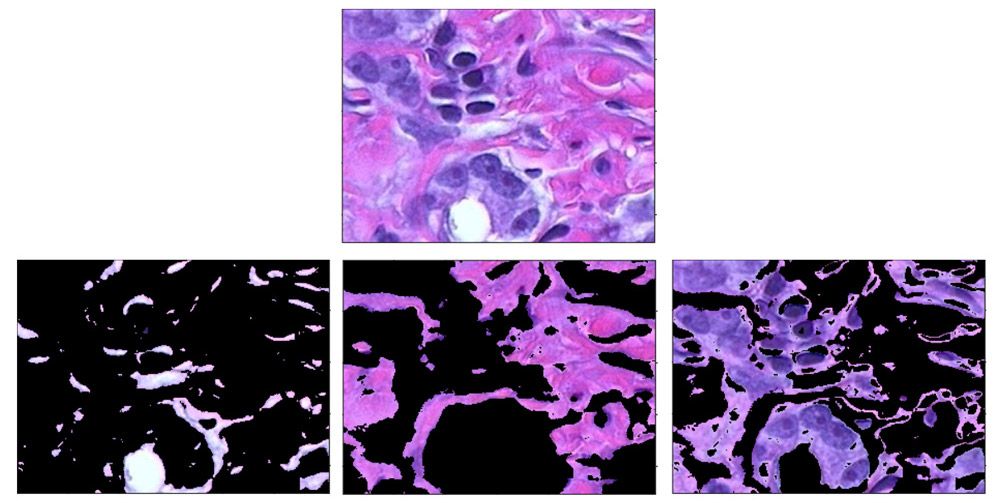 Using clustering to distinguish between tissue types in an image of body tissue stained with hematoxylin and eosin (H&E).