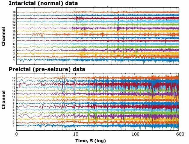 Multiple channels of signal data corresponding to EEG recordings obtained from an epileptic subject, during normal and pre-seizure periods.