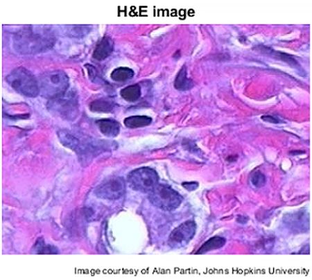 Image of tissue stained with hematoxylin and eosin.