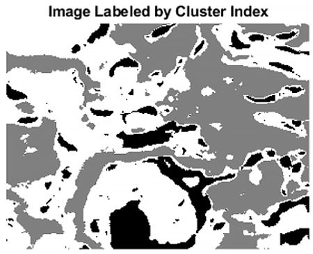 Image of tissue segmented into tree classes using cluster analysis.
